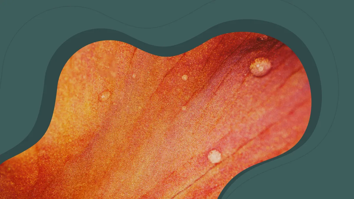 Adenomyosis vs. Endometriosis: Symptoms, Differences, and What to Do Next